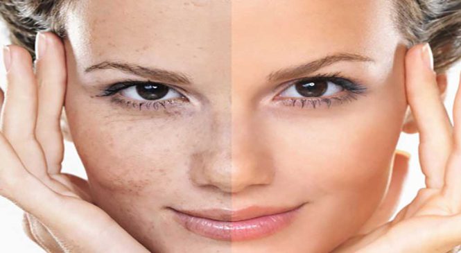 روش های موثر و نوین جوانسازی پوست کدامند